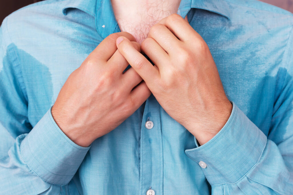 hyperhidrosis treatment options