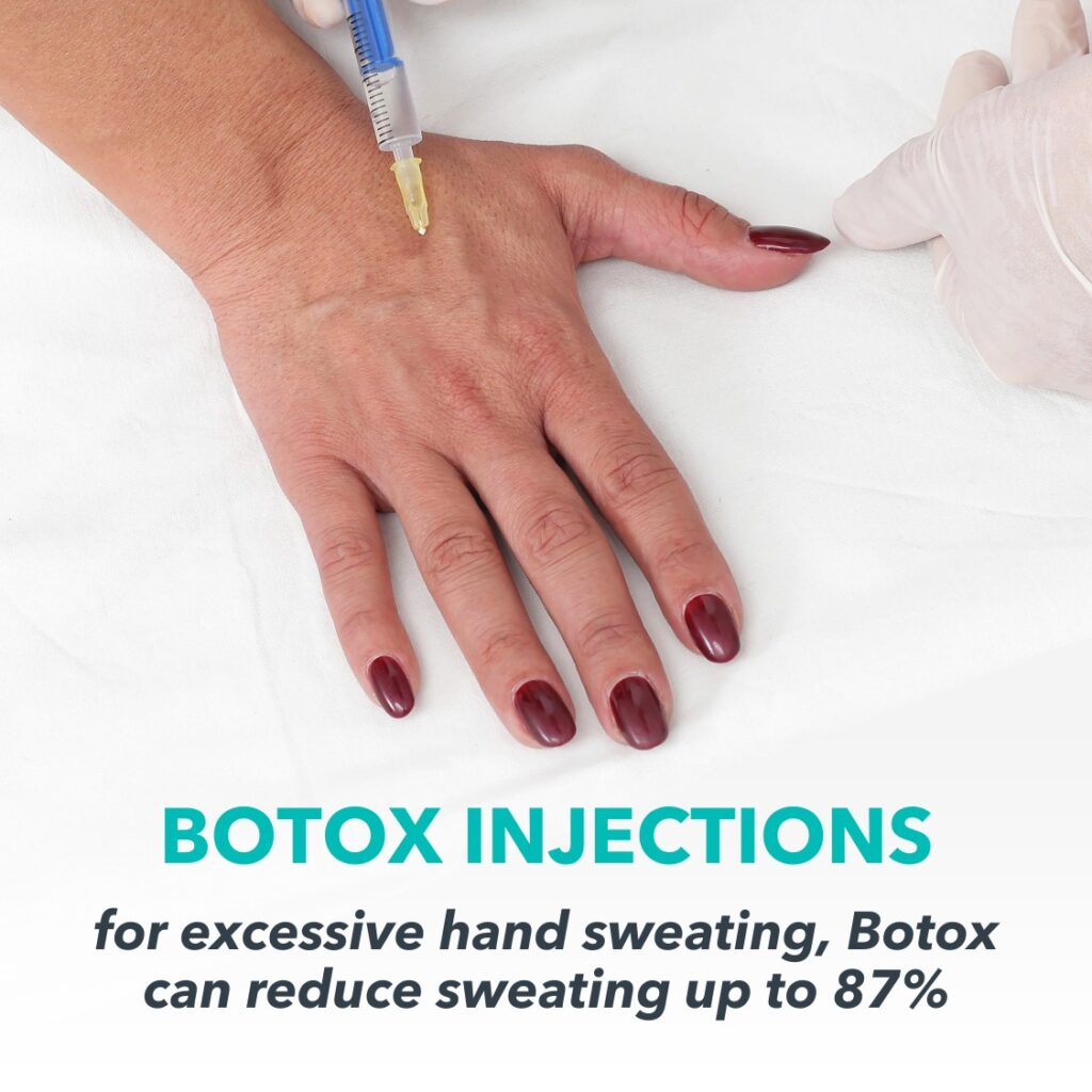 sweaty hand treatment