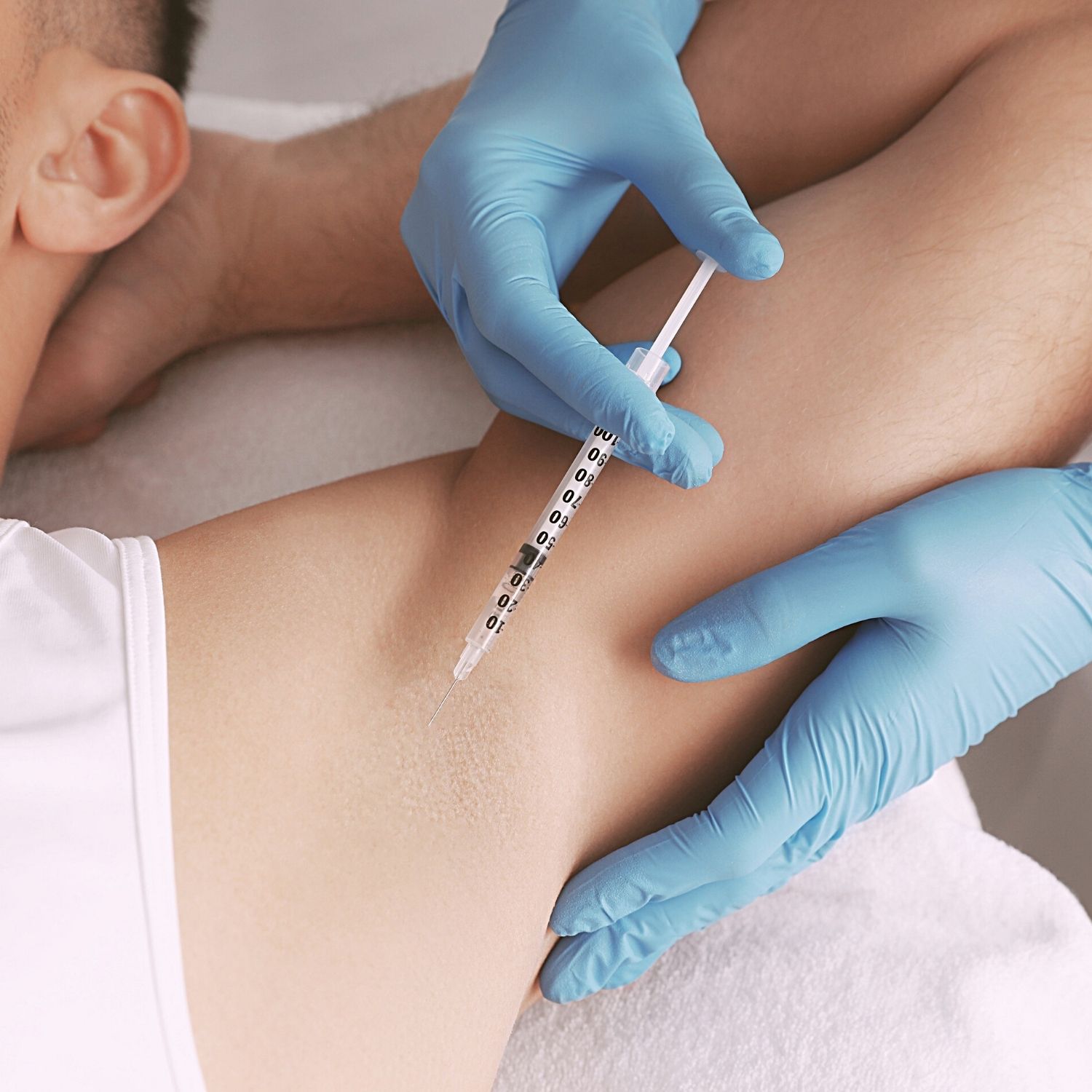 how to stop sweating so much with botox