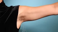 Sweaty Armpits